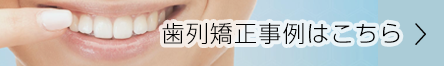 歯列矯正事例へリンク
