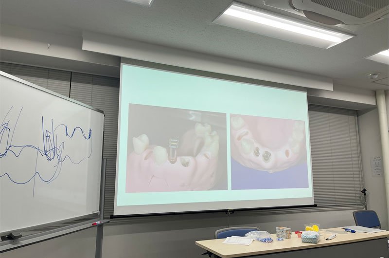 第2回 インプラントアドバンス写真01