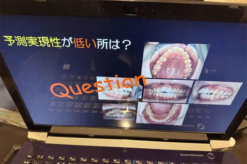 第1回 矯正症例検討会写真01