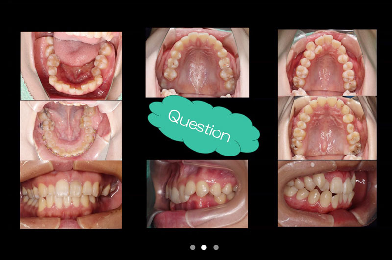 第1回 矯正症例検討会写真02